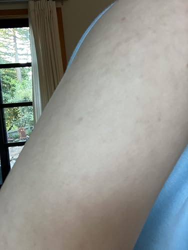 Adèle K. — avis Kurv+ soin corps boutons et taches