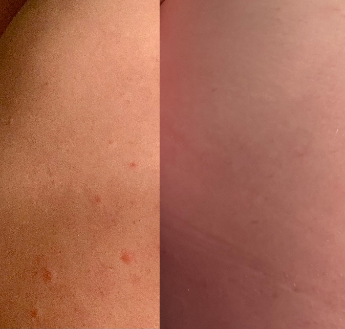 Camille V. — avis Kurv+ soin corps boutons et taches